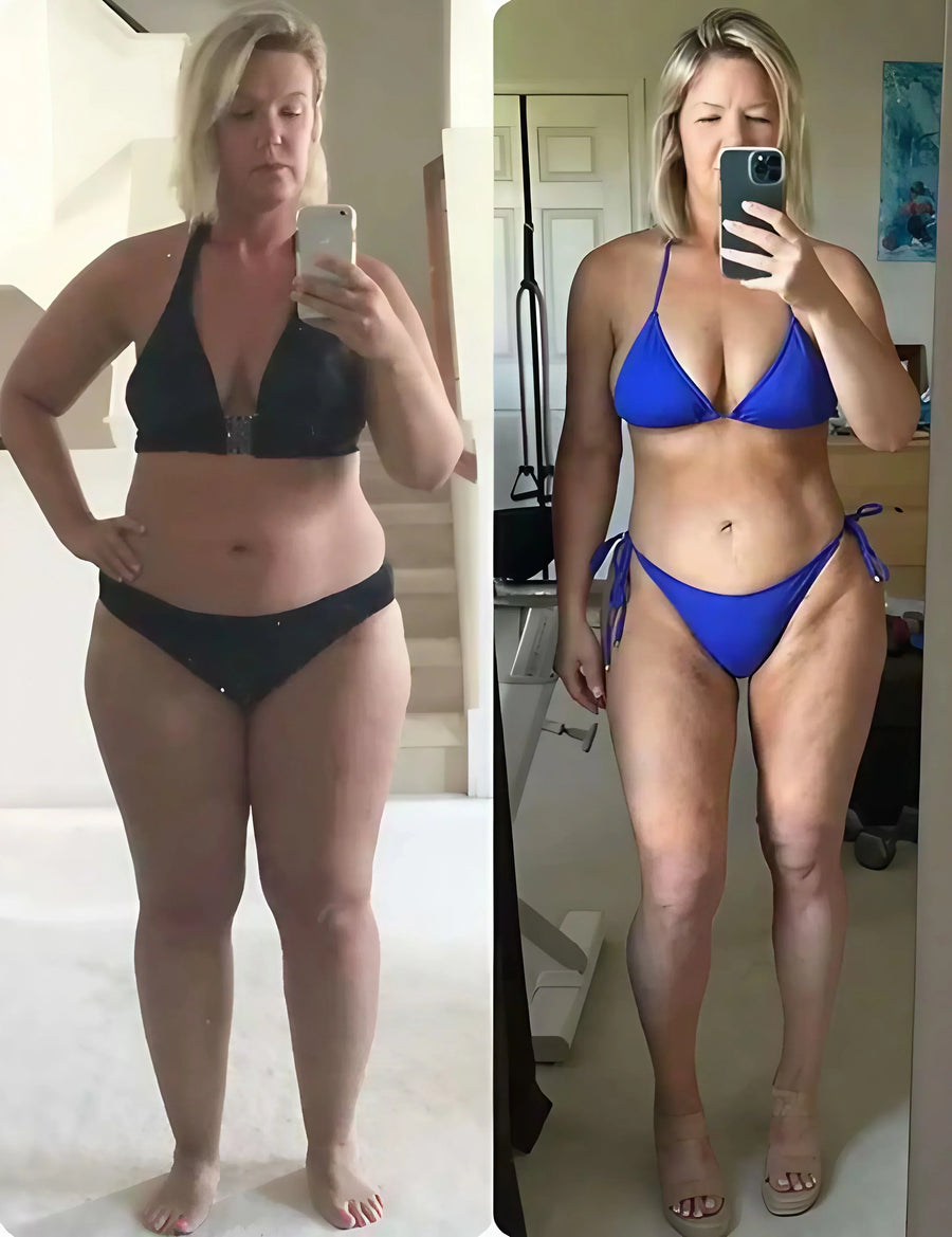 Deze natuurlijke methode hielp me eindelijk om mijn zware, pijnlijke benen slanker te maken – zonder operatie